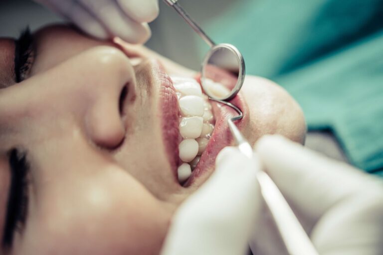 Carie non curata Carie non curata