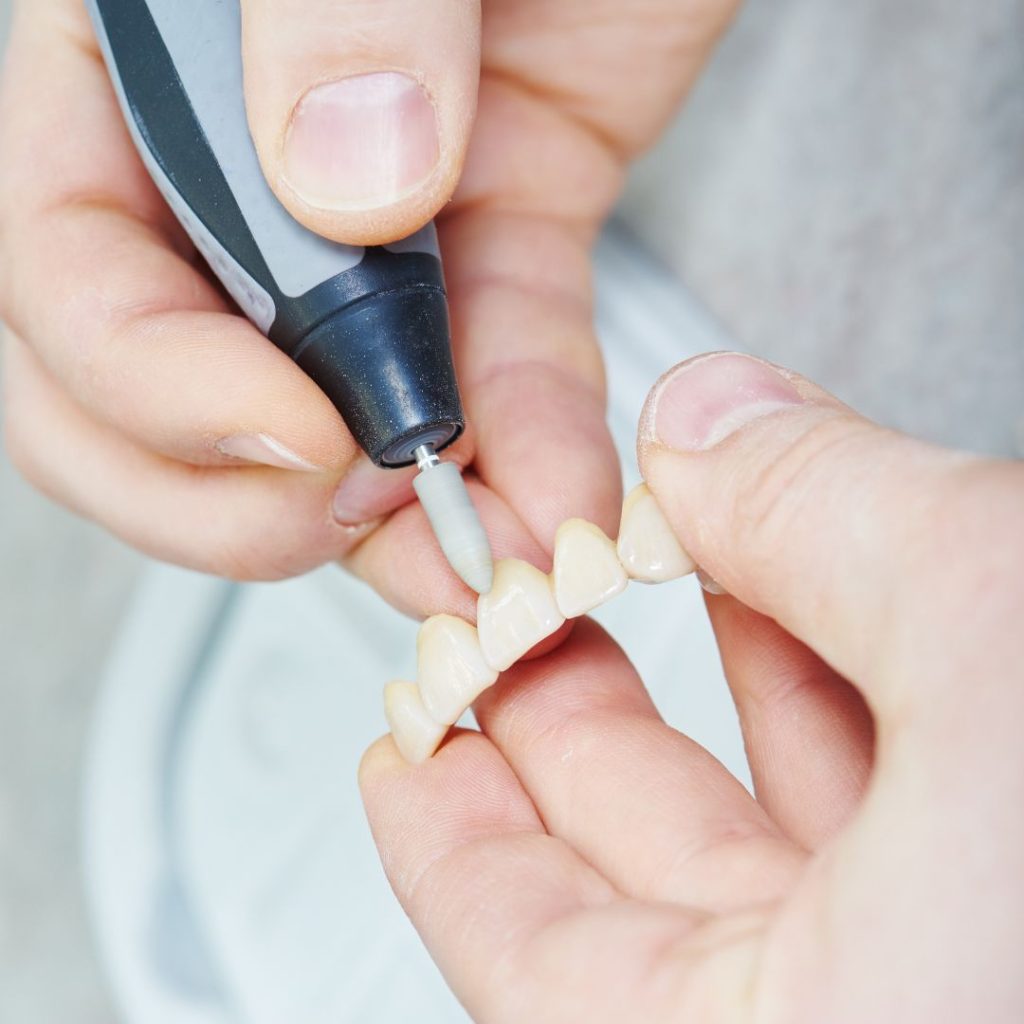 Protesi 1 Protesi fissa e dentiera a Sora - Fabi Odontoiatria