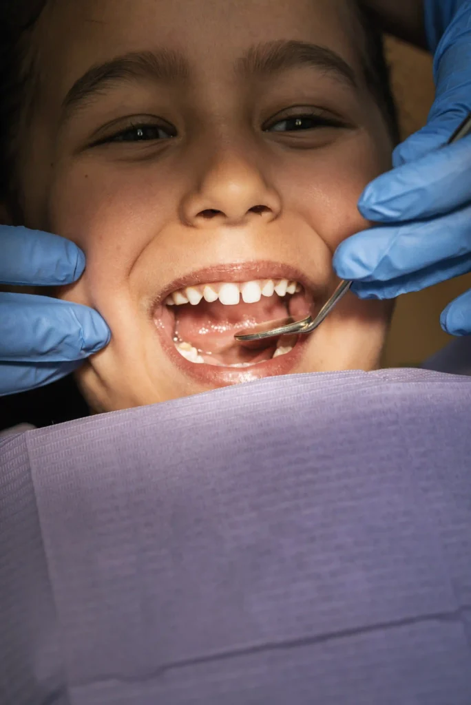 Quando iniziano a cadere i denti da latte 2 caduta denti da latte