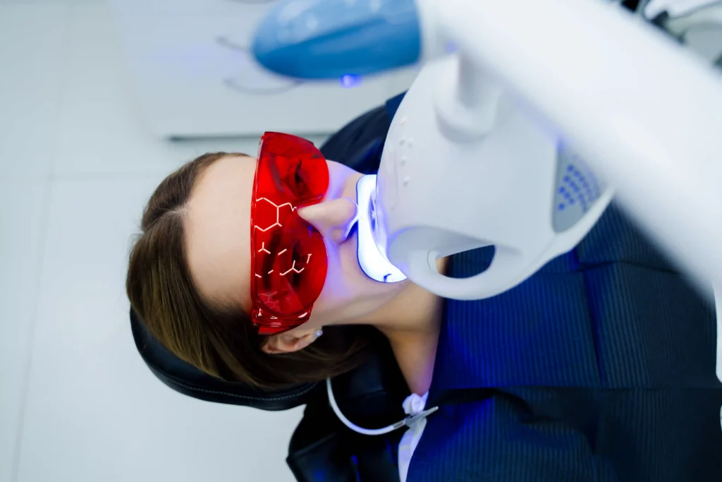 sbiancamento dentale dal dentista
