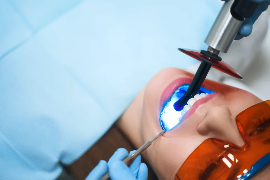 sbiancamento dentale dal dentista
